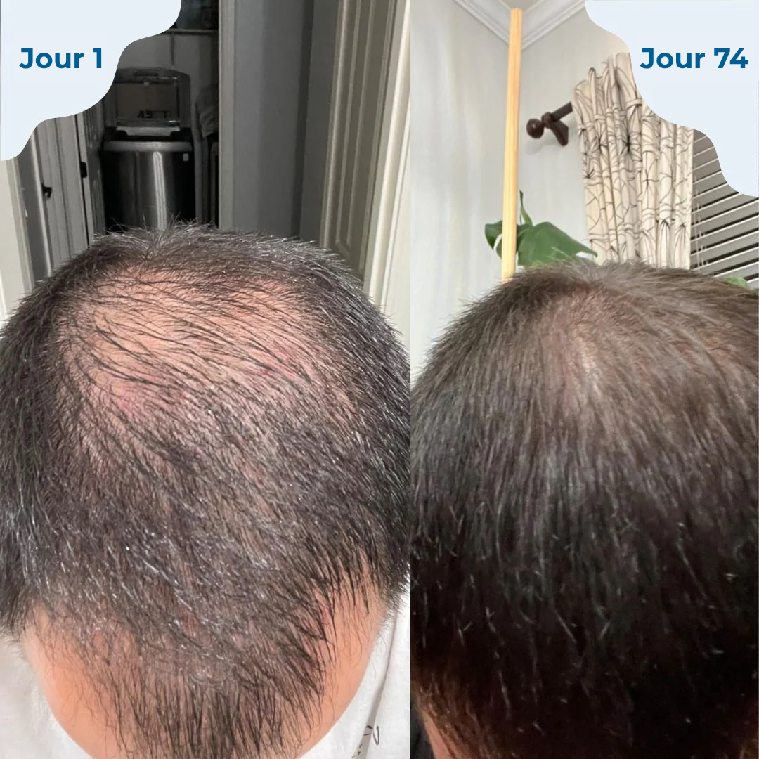 HAIRESSENCE™ – ROLL-ON POUSSE DES CHEVEUX