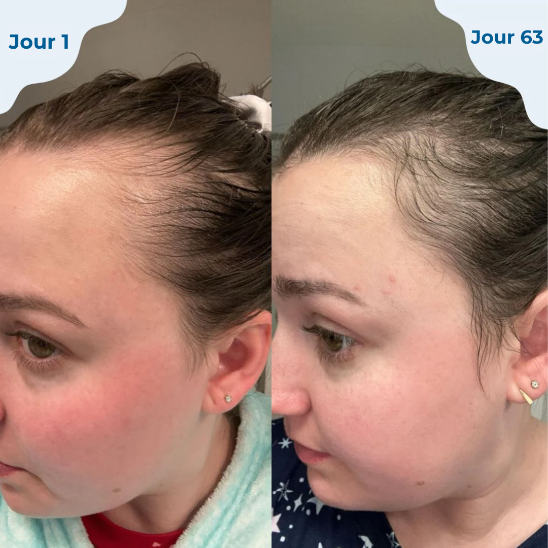 HAIRESSENCE™ – ROLL-ON POUSSE DES CHEVEUX